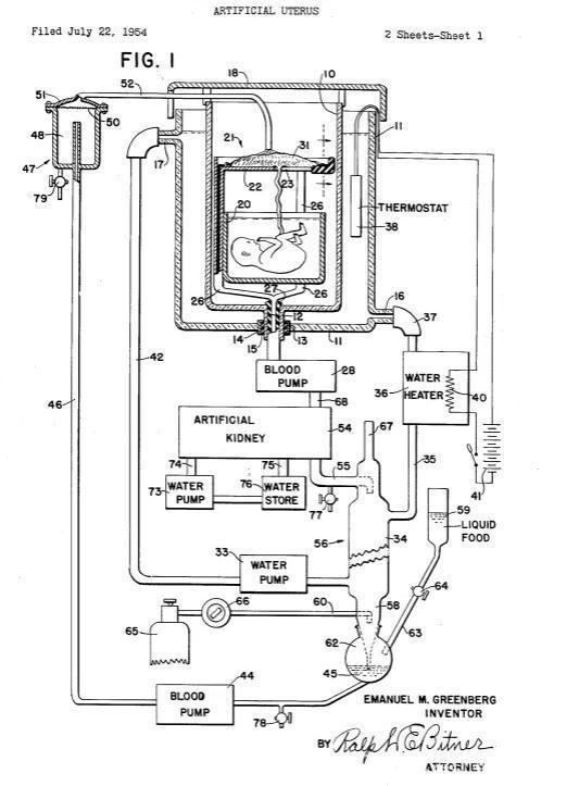 有望进入人体试验,人造子宫离我们还有多远?(图2) 有望进入人体试验,人造子宫离我们还有多远?(图2)