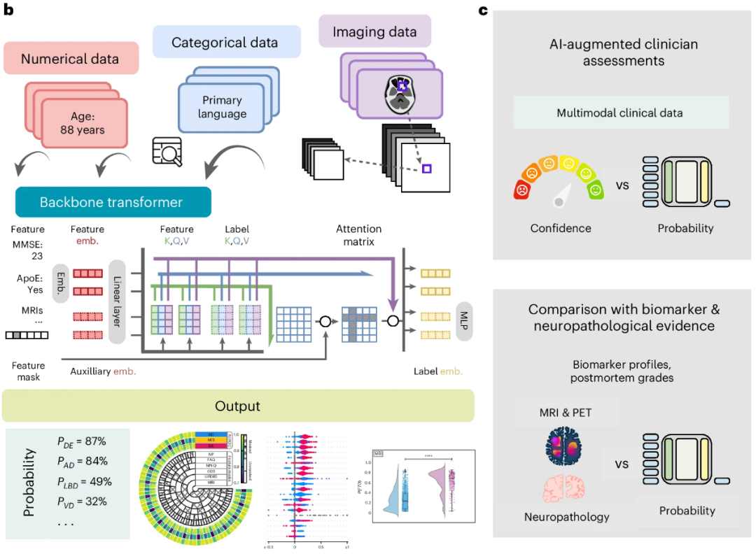 新的人工智能软件可以让医生更容易、更快地诊断失智症(图5)