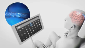 ChatGPT首次被植入人类大脑:帮助残障人士开启对话(图2) ChatGPT首次被植入人类大脑:帮助残障人士开启对话