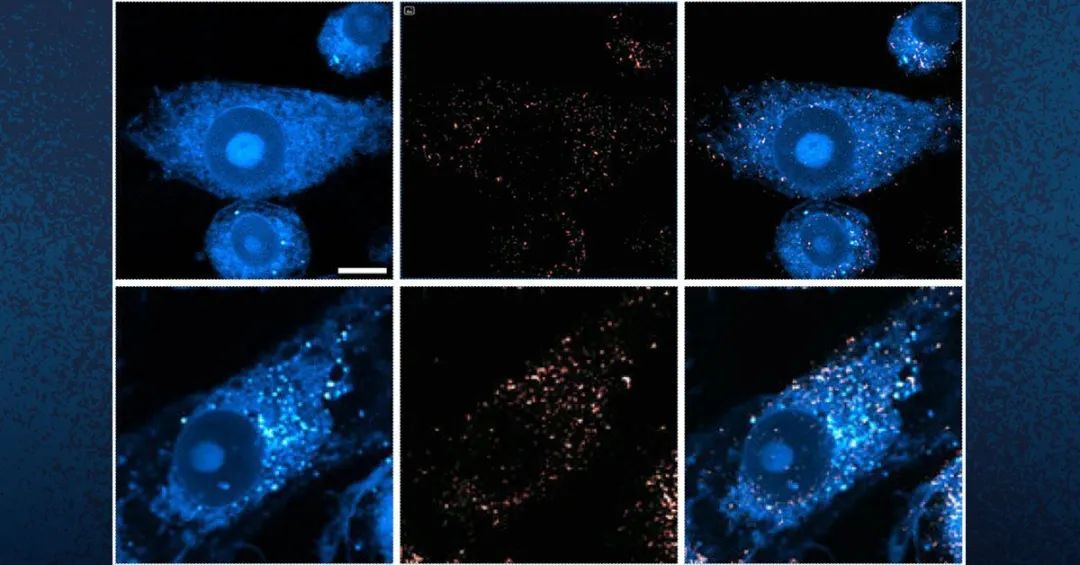 创新显微镜揭开了阿尔茨海默病代谢之谜(图6)