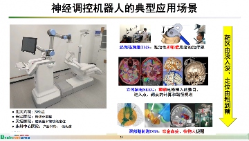 脑机接口医疗器械研发新突破,脑网络组图谱引领精准治疗时代(图10) 脑机接口医疗器械研发新突破,脑网络组图谱引领精准治疗时代(图10)