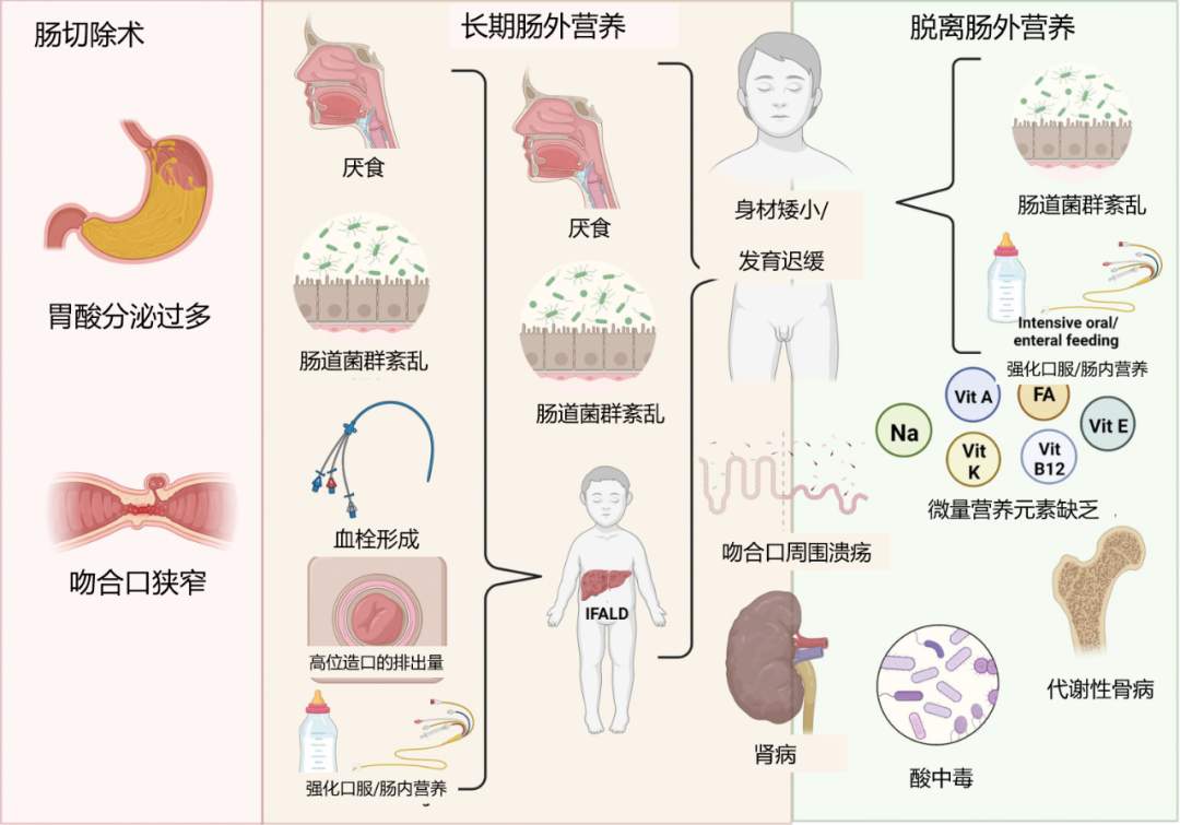 TidesPro | 国内首个GLP-2类似物替度格鲁肽获NMPA批准(图3) TidesPro | 国内首个GLP-2类似物替度格鲁肽获NMPA批准(图3)
