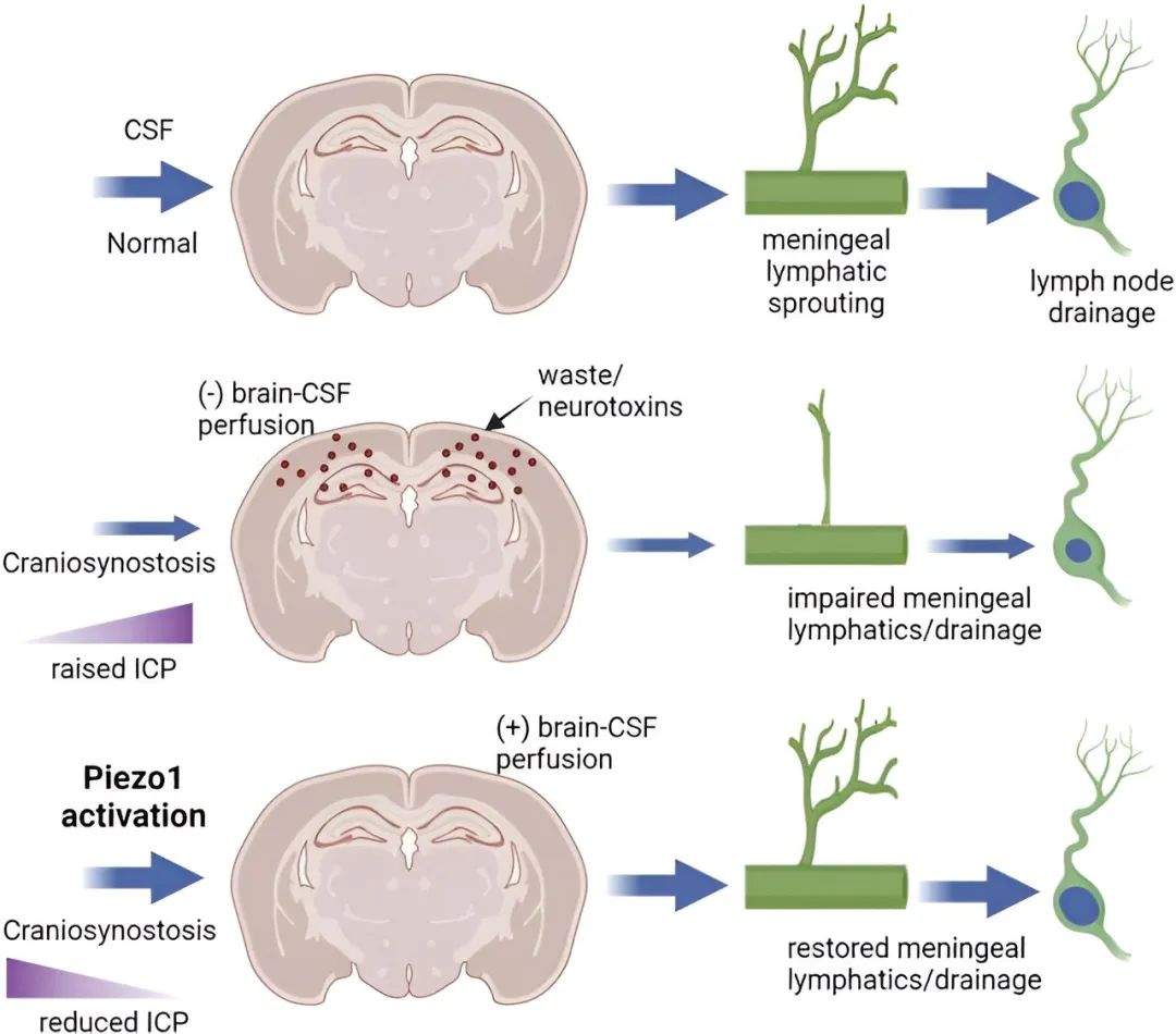一种药物可以修复大脑的排污系统(图4)