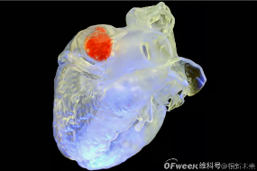 颠覆微创医疗，未来手术不用开刀了(图1)