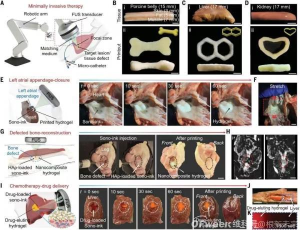 颠覆微创医疗，未来手术不用开刀了(图3)