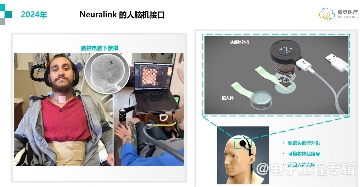 植入式脑机接口技术突破：微灵医疗引领医疗器械创新发展(图3)